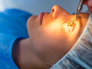 cirurgia refrativa